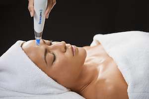 Dermapen - Microneedling