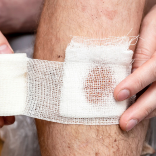 Bacterial skin infections consultation