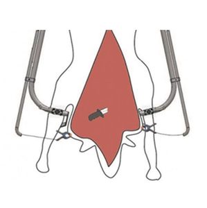 Termet Carcass Spreader & Clip Air • Argus