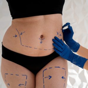 Fat Loss & Sculpting