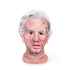 Rudie Sonneberg With Stroke - Gaumard Hal Facial Overlay