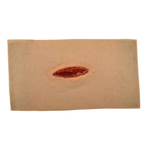 Small Laceration