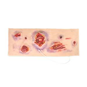 Wrap Around: Multiple Abdominal Gun Shot Wounds (New)