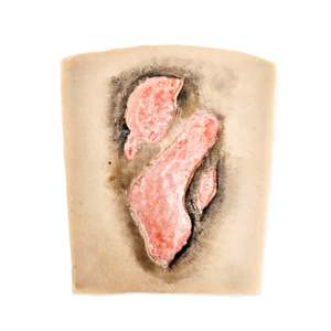 Small Fire burn