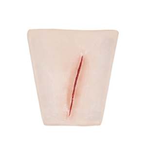 Wrap Around: Suture Wrist laceration