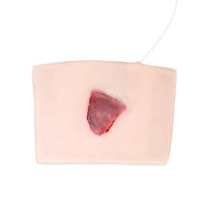 Elderly Skin Tear