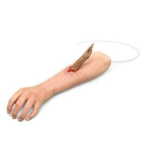Haemorrhage Training: Trauma Training Lower Arm With Foreign Object