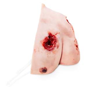 Haemorrhage Training: Trauma Wound Packing Shoulder