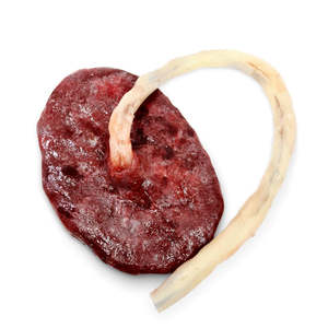 Skills Trainers: Placenta And Umbilical Cord