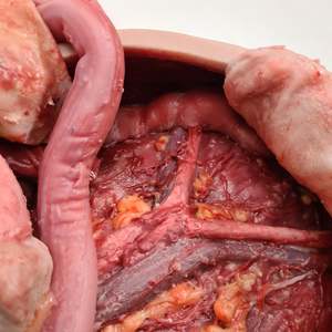 Skills Trainers: Abdominal Model
