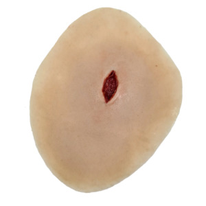 Sucking chest wound