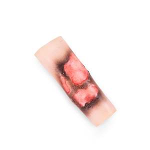 Fire Burn Sleeve