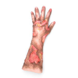Burned Arm Long