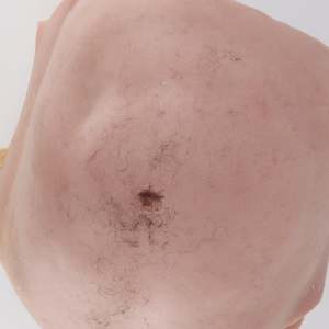 Belly skins