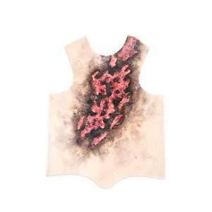Torso Burned