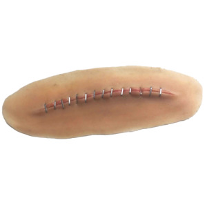 Stick-on C- section wound with staples