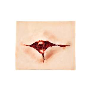 Wound Simulation: Open Fracture Trauma
