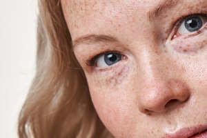 Skin Health Membership: Skin Health Maintenance Plan Level 1
