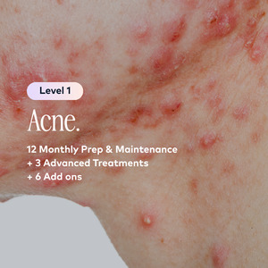 Acne Level 1 Plan
