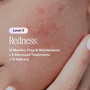 Redness Membership: Redness Level 3