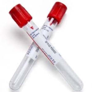 Consumables: Red Top Vacutainer