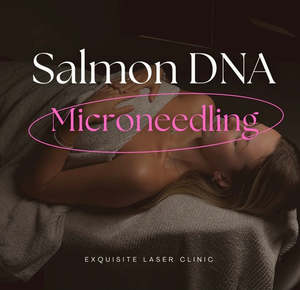 Christmas Collection 2022: Microneedling Salmon DNA PDRN Treatment Full Face