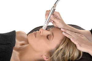 Microdermabrasion Treatment