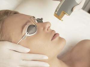 Treatment Promotions 1: Laser Genesis Skin Rejuvenation Full Face