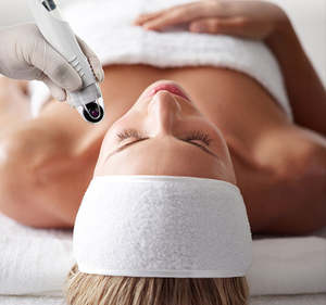 Treatment Promotions 1: Dermafrac 4 in 1 Skin Rejuvenation