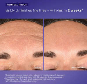 Dermalogica: Dermalogica phyto nature e² regenerating daily exosome leave-on treatment