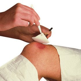 First Aid 1: Melolin Low-adherent Dressing Single