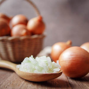 Onions Leeks: Onions Brown Medium 5kg each