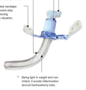 Anaesthesia: Tracheostomy Tube - Cuffed