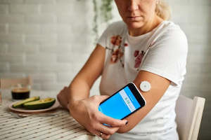Constant Glucose Monitering Service (CGM)