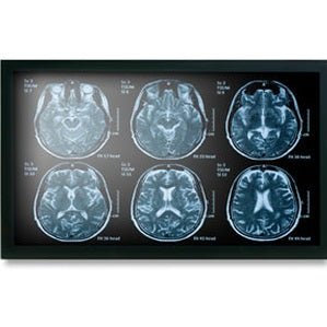 Onyx MEDDP-622HNN 21.5" Medical Display