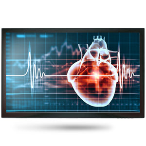 Onyx MEDDP-615HPN 15.6" Medical Touch Display