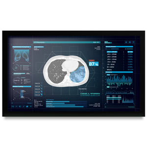 Onyx: Onyx MEDDP-627HNN 27" Medical Display