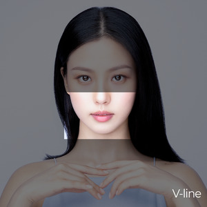 Ultraformer MPT V-Line Lifting (Jawline Lift) KB April 2023