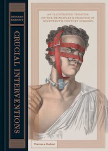 Bodies: Crucial Interventions: An Illustrated Treatise on the Principles & Practice of Nineteenth-Century Surgery