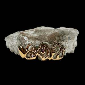 custom made grillz: Flame Grillz, four teeth in 9kt Rose Gold