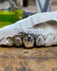 Products: Custom Made Grillz - Single tooth capped in solid Sterling Silver