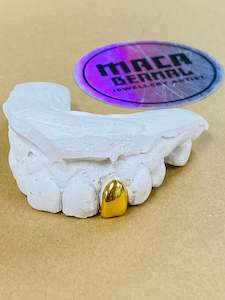 Products: Deposit for One capped tooth in Stg Silver