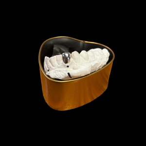 Custom Made Grillz: Four teeth in 18kt gold