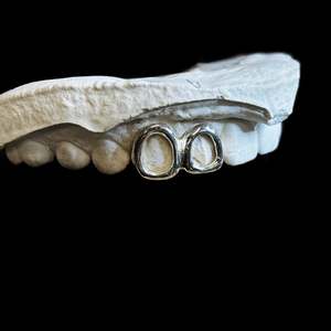 Custom Made Grillz: Two teeth in Sterling Silver, frames