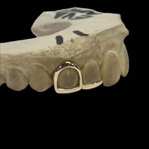Custom Made Grillz: One frame and one bottom bar in 9kt gold