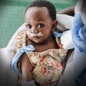 Products: Cleft lip or palate surgery $400