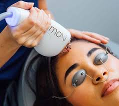 Skin Treatment: Moxi Laser
