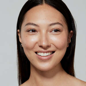 Skin Treatments: Cosmelan Peel