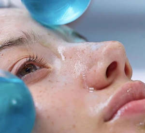 Treatments: Fire and Ice Facial