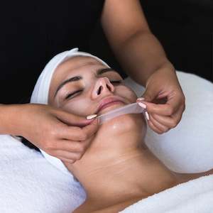 Treatments: Skin Peels